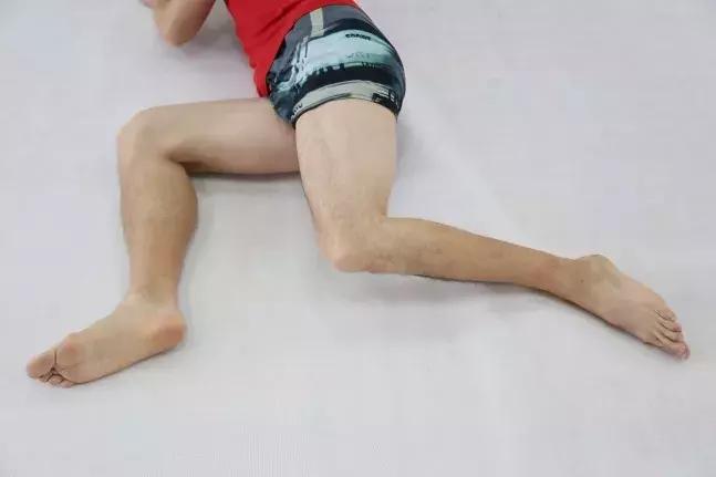 跑者”专利”:一文看懂膝外侧疼痛如何解决