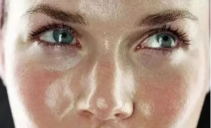 螨虫离开床上螨虫最怕3个克星,家里长了螨虫用什么方法最好