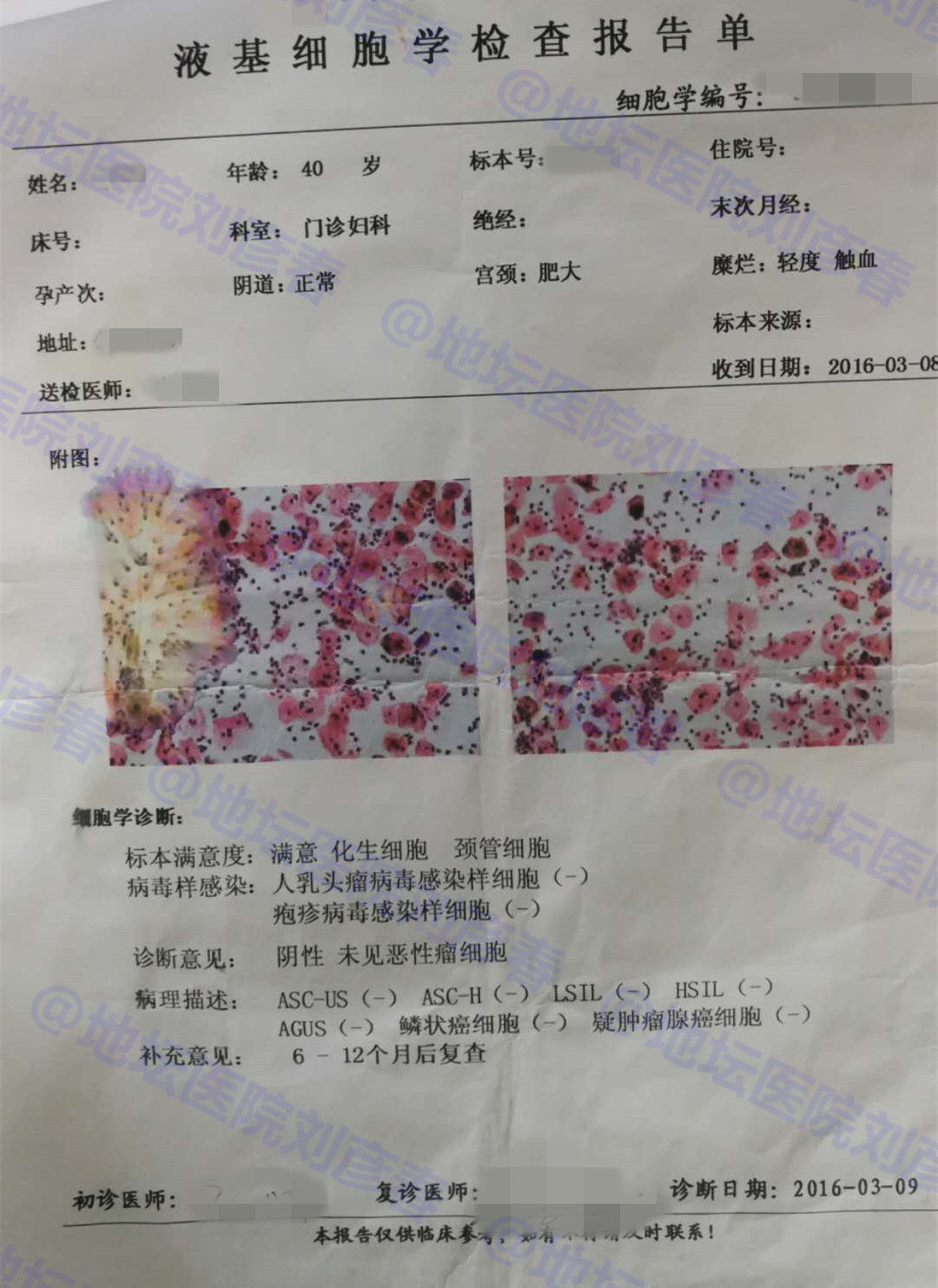 宫颈切除hpv持续感染怎么办,宫颈病变切除后hpv16阳性