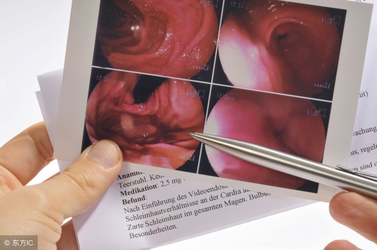 为什么医生叫你做胃镜,做胃镜怕疼听听消化科医生怎么说