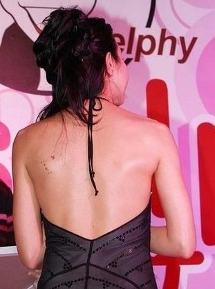 什么情况下胎儿脸上会长胎记,什么原因导致胎儿脸上有胎记