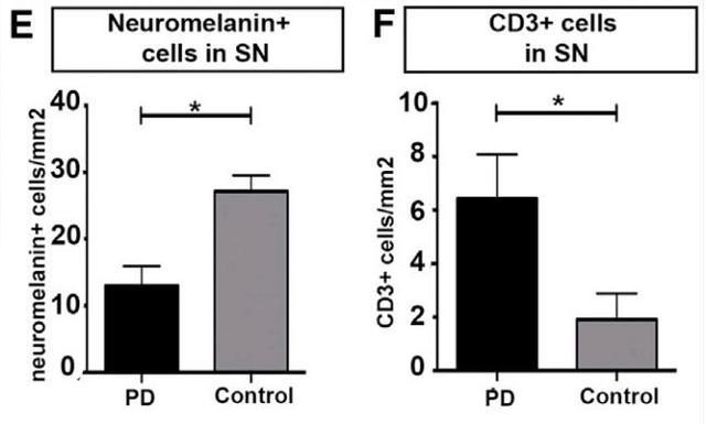 神经科学帕金森病,帕金森最终死亡原因