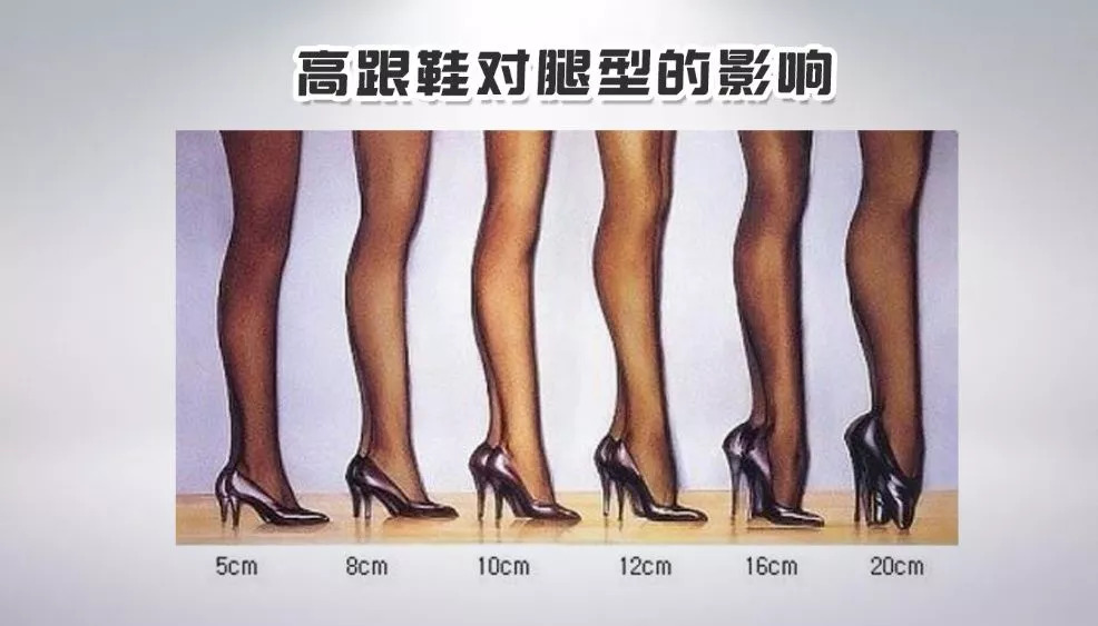 腿部网状静脉曲张的最快消除方法,怎样治静脉曲张和蚯蚓腿