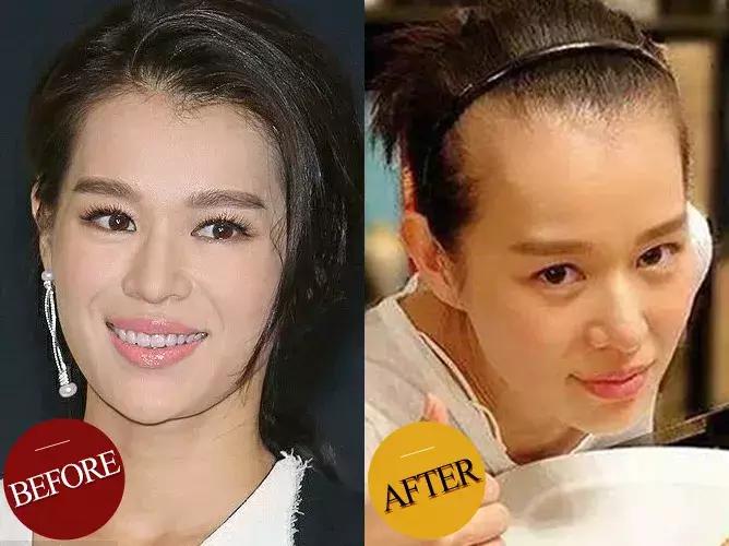 防脱发女生,防脱发明星代言哪个好