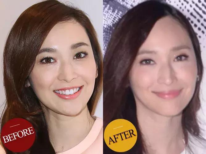 防脱发女生,防脱发明星代言哪个好