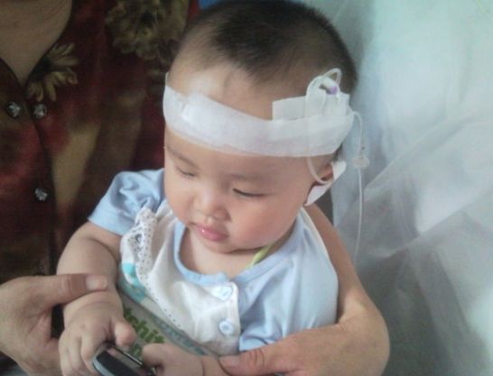 孩子夜间呼吸困难最快解决方法,孩子呼吸喘得厉害怎么缓解