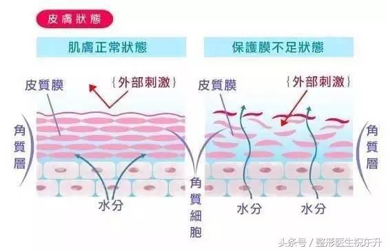 水光针打几针能改善毛孔,水光针打一次效果图