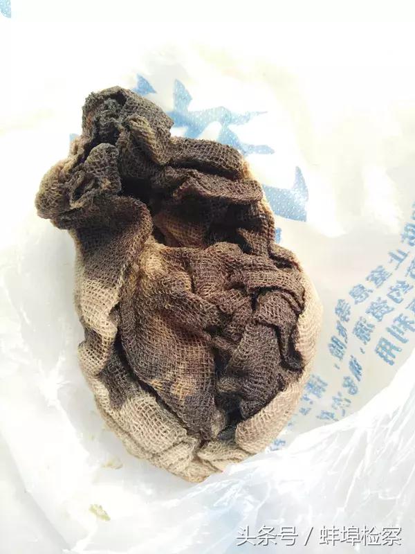 做了人流几天后腹痛还排出异物,女生流产手术后小肚子大