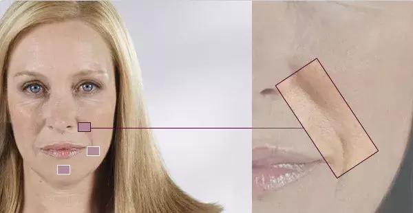 除了发量,最暴露年龄的可能是这两道纹