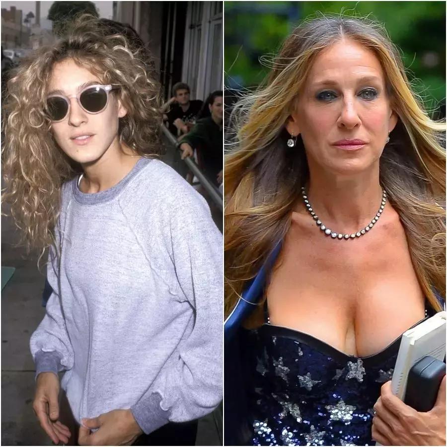 除了发量,最暴露年龄的可能是这两道纹