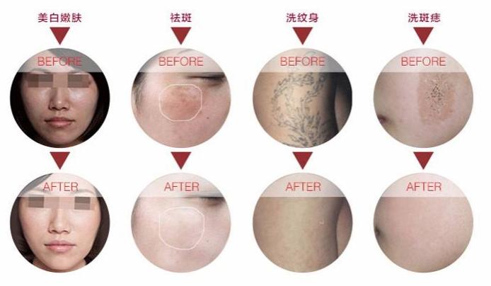 范冰冰推荐祛斑,范冰冰推荐美白淡斑面膜