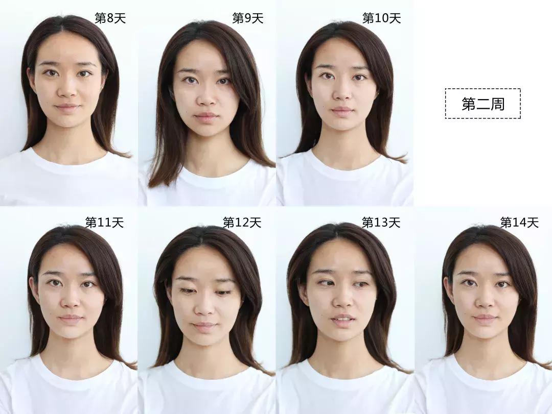 vc精华去法令纹,vc可以消除法令纹吗