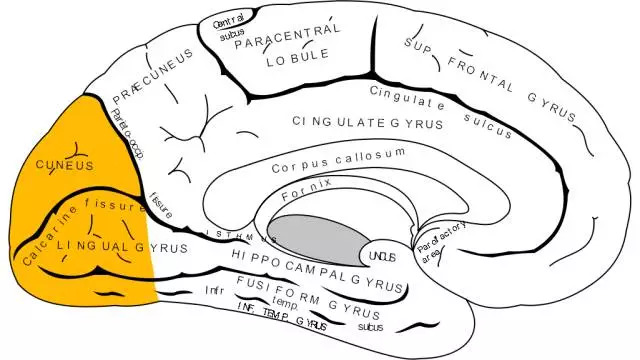 不识妻子脸盲症是什么,轻度脸盲症能分清美丑