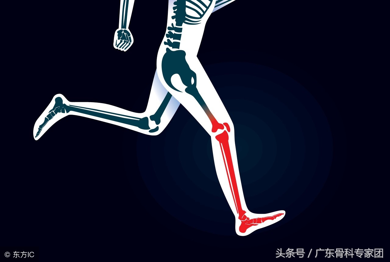 骨折后初次下地下肢发麻正常吗?骨折后康复训练得注意这些