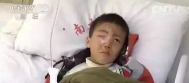 男孩眼珠融化的原因,孩子眼球融化的危害