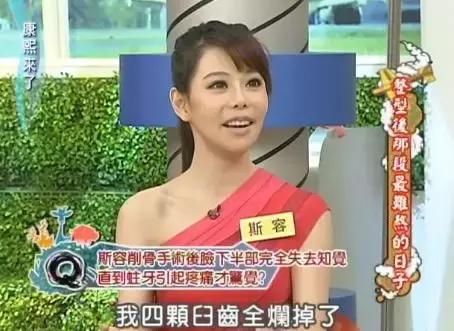 花百万整形60多次被嘲青蛙脸，这个台湾女主持真豁得出去