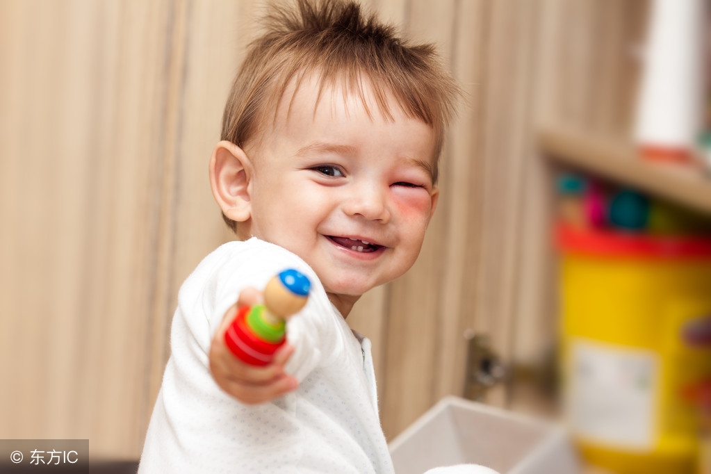 小孩碰伤出血能用碘伏消毒吗,小孩外伤擦碘伏会不会疼