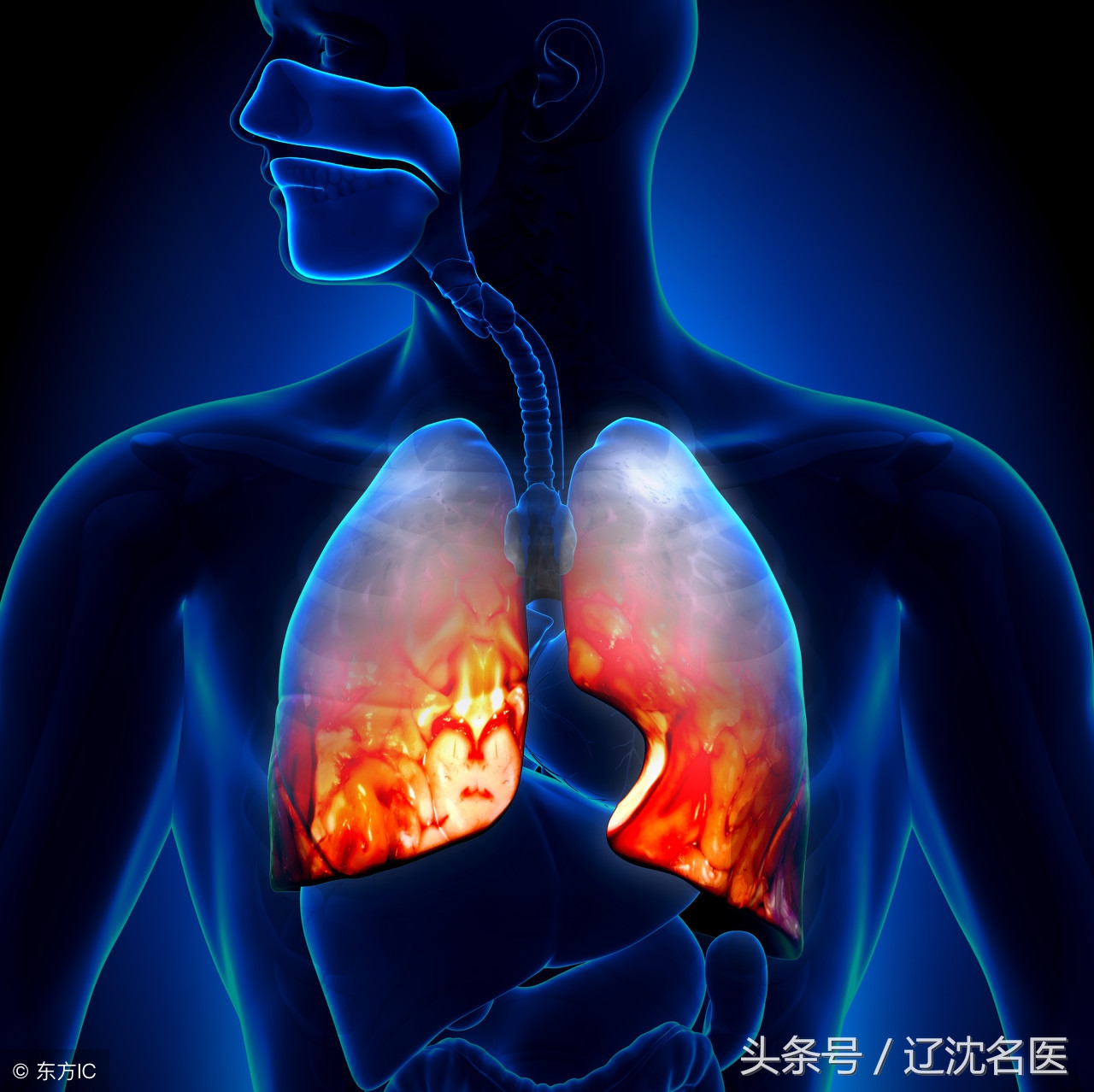 治慢阻肺有名的医院,治疗慢阻肺第一名的医院