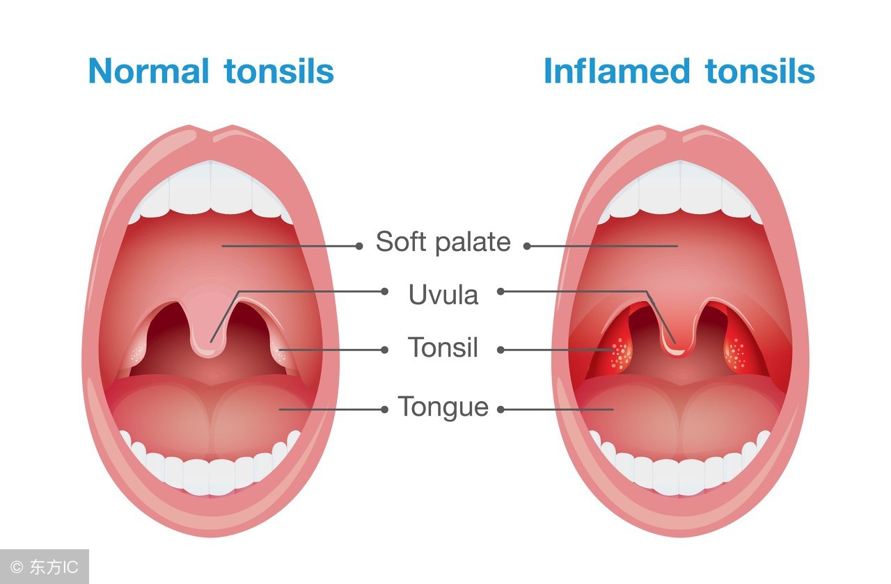 宝宝咳嗽差点喘不上气，医生怒骂！学会辨别咳嗽原因太重要