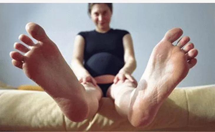 香港脚怎么彻底治愈,香港脚怎么根除