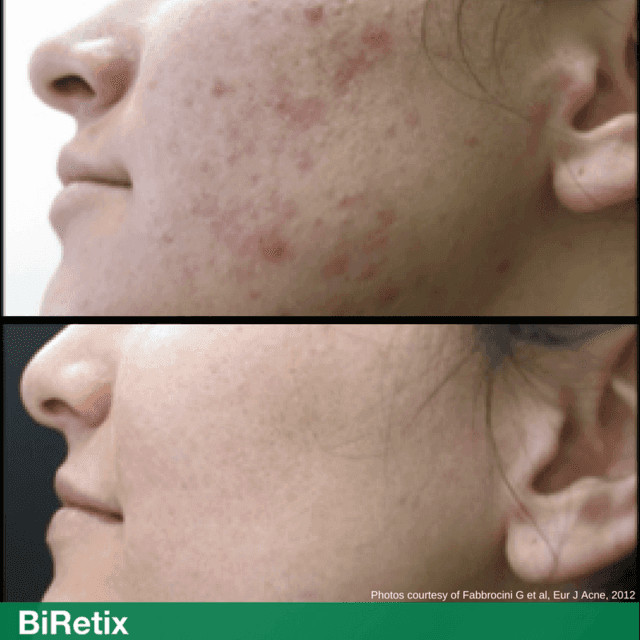 除了日本其他国家的护肤品,西班牙必备药妆品牌排行榜