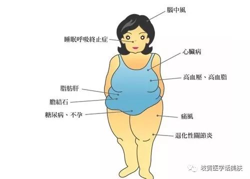 穴位埋线减肥新技术,穴位埋线减肥一年一次的效果