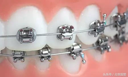 想变美但又怕手术,想变美又怕疼怎么办