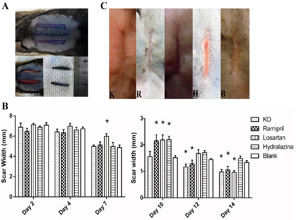 保护内皮的降压药,什么降压药对皮肤无副作用