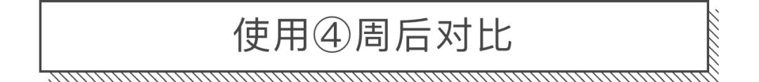 30天花80块去掉陈年老痘印到底有没有可能？