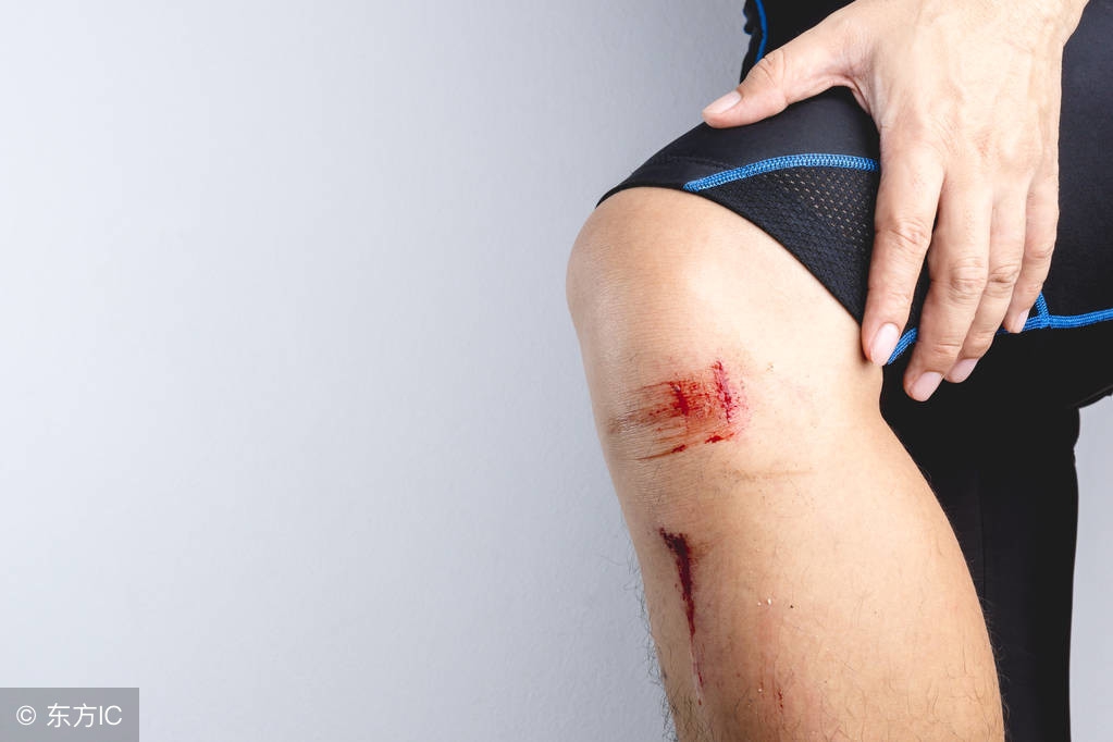 跑步摔了膝盖擦伤怎么办,跑步摔破皮了第二天还能跑吗