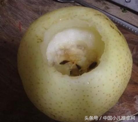 婴儿咳嗽的特效药,咳嗽喉咙发痒小偏方