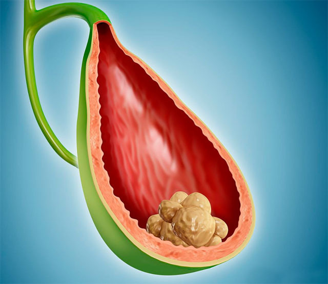 身上的小息肉可以割掉吗,身上到处长息肉怎么解决