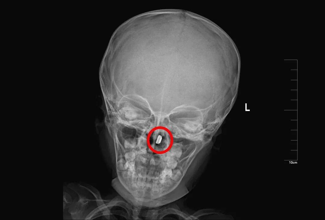 一些让人毛骨悚然拍到的照片,六个令人毛骨悚然的影像