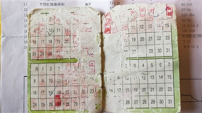 大妈沉迷保健品视频,大妈痴迷蛋白粉致浮肿去世前还吃