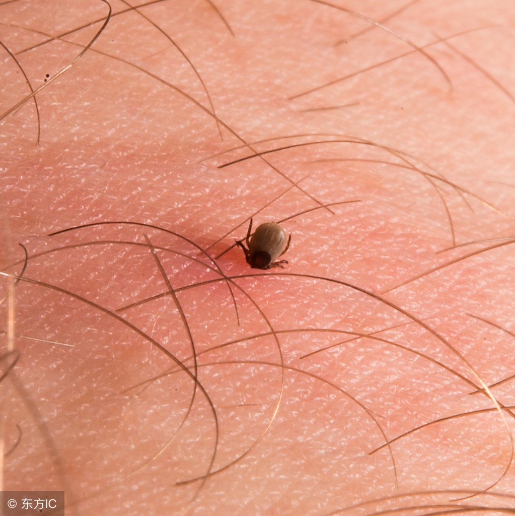 床垫有螨虫小孩睡了过敏,螨虫过敏者铺什么床垫最好