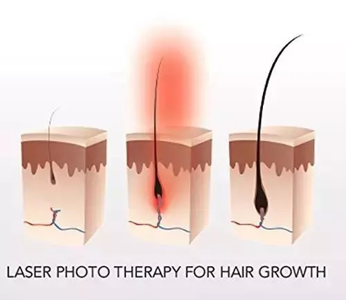 万事屋推荐|不想变秃的十二星座,这可能是目前为止世界上最有效的生发方案