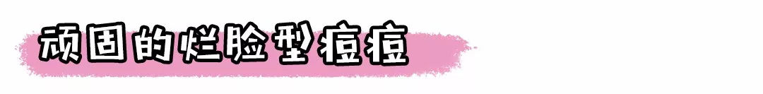 痘痘肌,痘痘肌必看五种痘痘类型