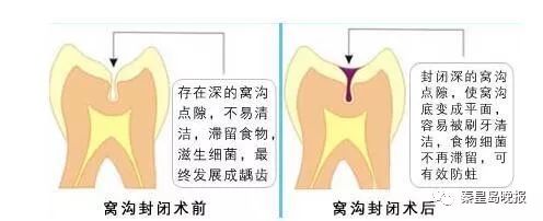 让笑容更自然的办法,三个动作可以让笑容变灿烂