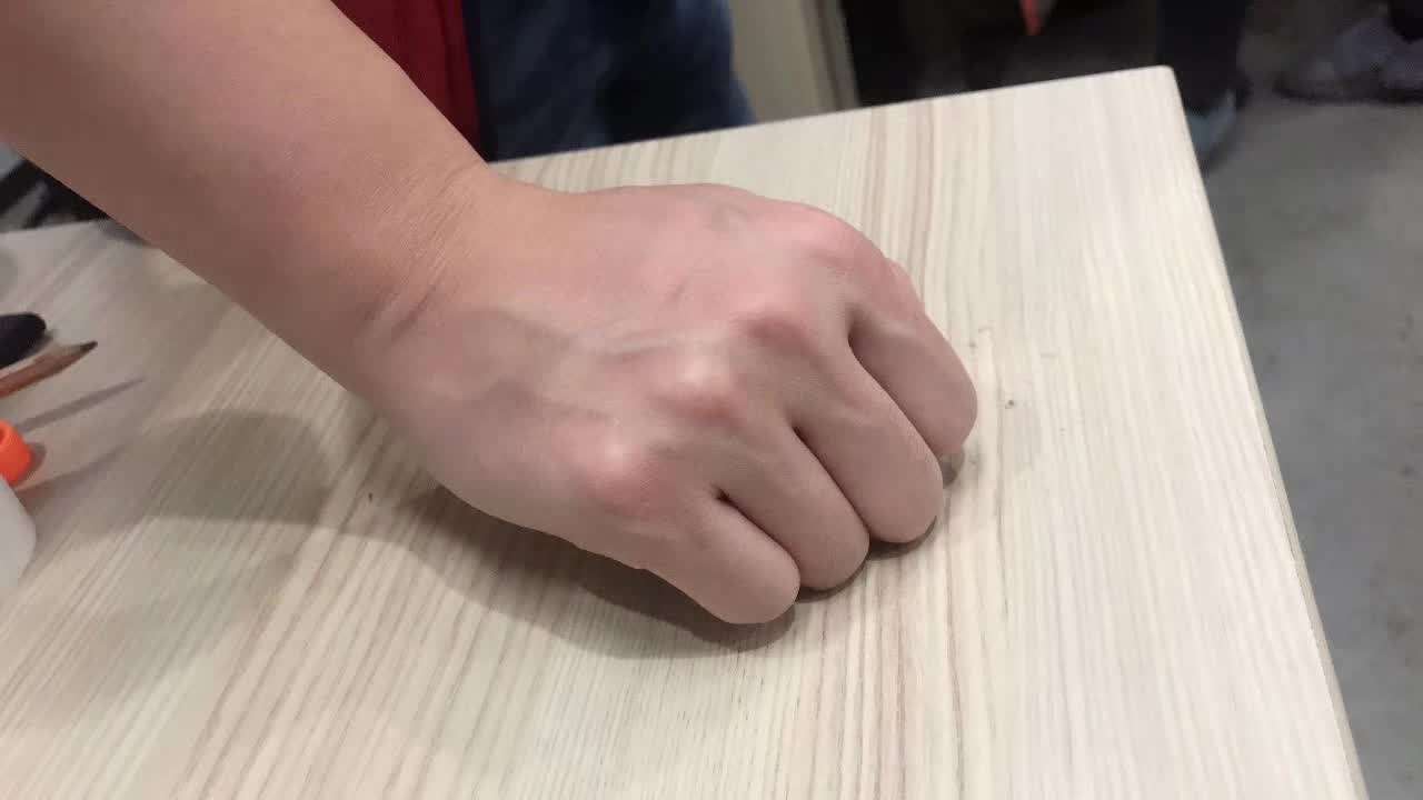 手背脚背青筋暴起是血管堵了吗,手背青筋凸起血管有个米粒小疙瘩