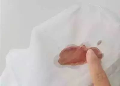 衣服不管染上什么用这招都能洗掉,白色衣服染上颜色用什么方法洗掉