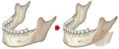 娣卞湷棰岄潰澶栫鏁村舰,娣卞湷鍙ｈ厰鍖婚櫌棰岄潰鏁村舰