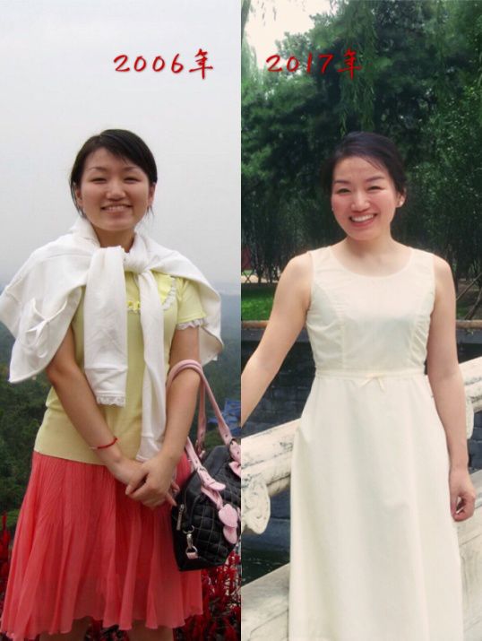 返场预告|第一次降价，Tripollar童颜机重塑脸部胶原，效果堪比医美级，如果一生只选一样美容品，必须就是它！