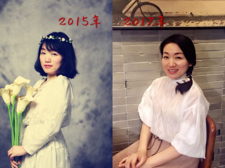 童颜机tripollar宙斯,童颜机tripollar溶脂