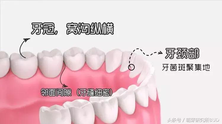 儿童牙齿龋齿怎么处理和保养,乳牙龋齿怎么办有好方法吗
