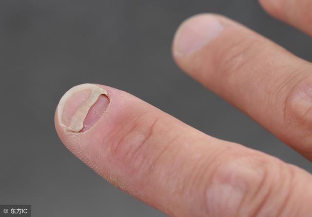 指甲吃什么食物长得快,指甲有关的食物