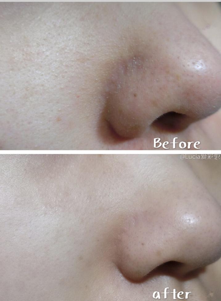 真的火了很多年的luna洁面仪,luna洁面仪韩国版