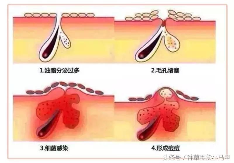医美面膜真的好用吗,医美面膜是真的好用吗