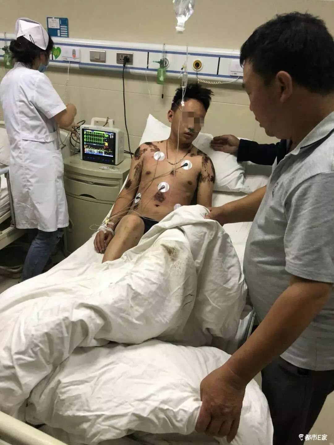 男子被马蜂蛰三下后去世,男子被黄蜂蜇致其身亡