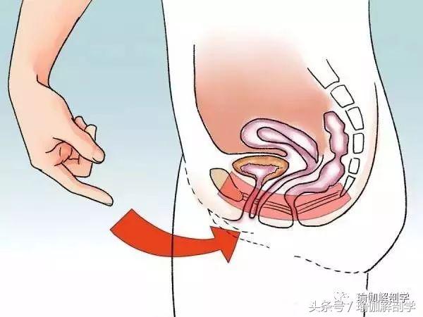 十大最好的盆底肌锻炼方法,女人盆底肌强壮有力的好处