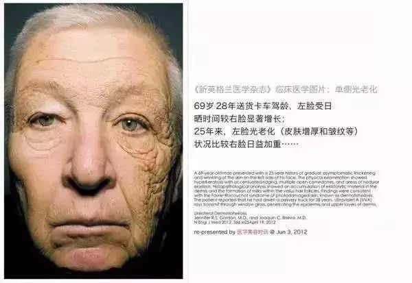 实用丨不防晒=变黑+变老!10款口碑防晒请收好!